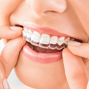 有哪些類型的箍牙治療可用？
